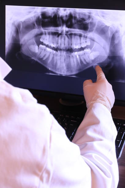 Best Urgent Care for Lost Fillings or Crowns in Emerson, NJ