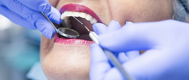Best Emergency Treatment for Dental Infections or Abscesses in Emerson, NJ
